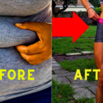 Ozempic for Weight Loss in Prediabetes